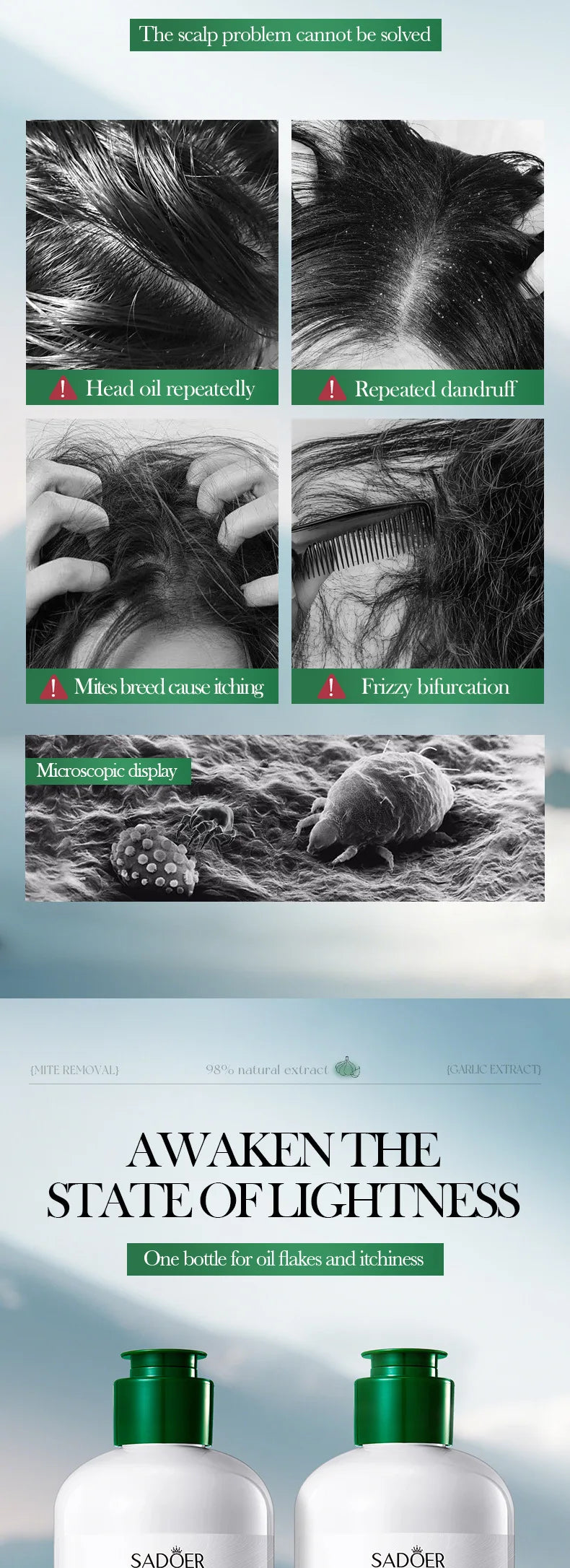 Garlic Anti-Mite Shampoo - Deep cleansing scalp care, specially designed for dandruff and itchy scalps.