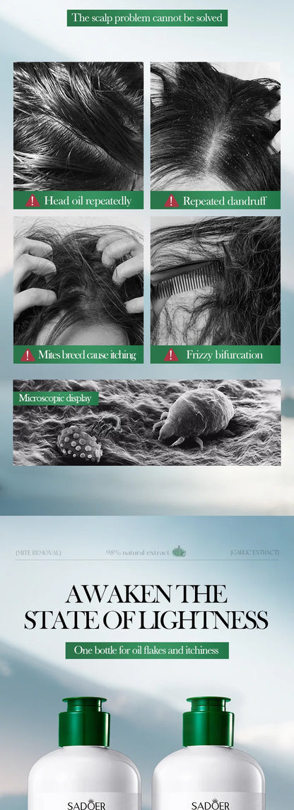 Garlic Anti-Mite Shampoo - Deep cleansing scalp care, specially designed for dandruff and itchy scalps.