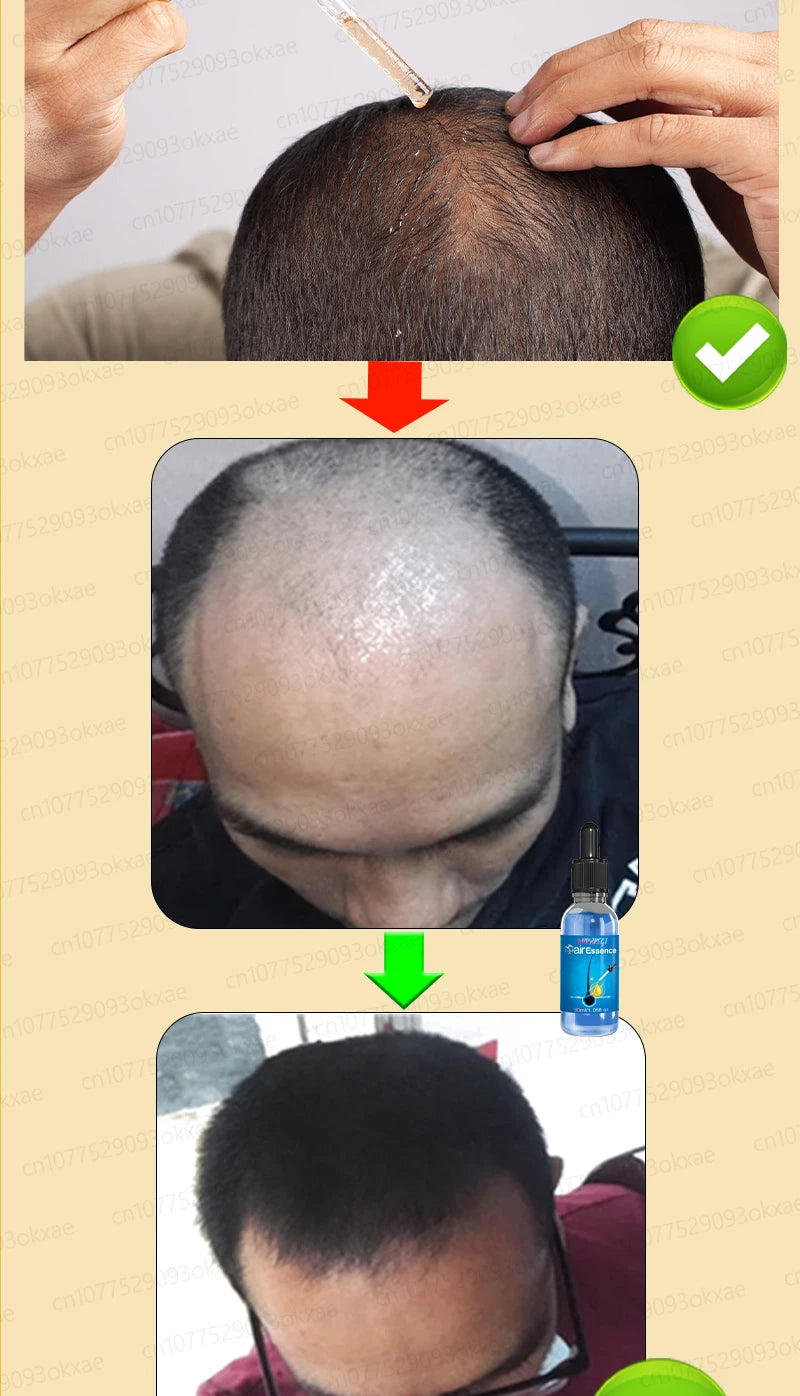 WPRBREGT blue bottle.hair growth essential 0iI. Say goodbye to baIdness. The secret 0f thick hair hair growth serums