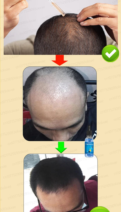 WPRBREGT blue bottle.hair growth essential 0iI. Say goodbye to baIdness. The secret 0f thick hair hair growth serums