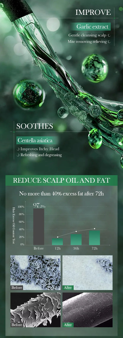 Garlic Anti-Mite Shampoo - Deep cleansing scalp care, specially designed for dandruff and itchy scalps.